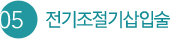 5. 전기조절기삽입술