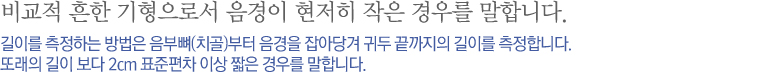 비교적 흔한 기형으로서 음경이 현저히 작은 경우를 말합니다. 길이를 측정하는 방법은 음부뼈(치골)부터 음경을 잡아당겨 귀두 끝까지의 길이를 측정합니다. 또래의 길이 보다 2cm 표준편차 이상 짧은 경우를 말합니다. 