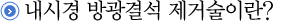 내시경 방광결석 제거술이란?