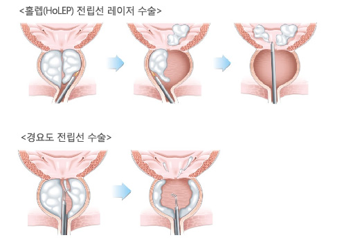 관련이미지