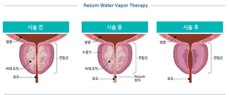 관련이미지